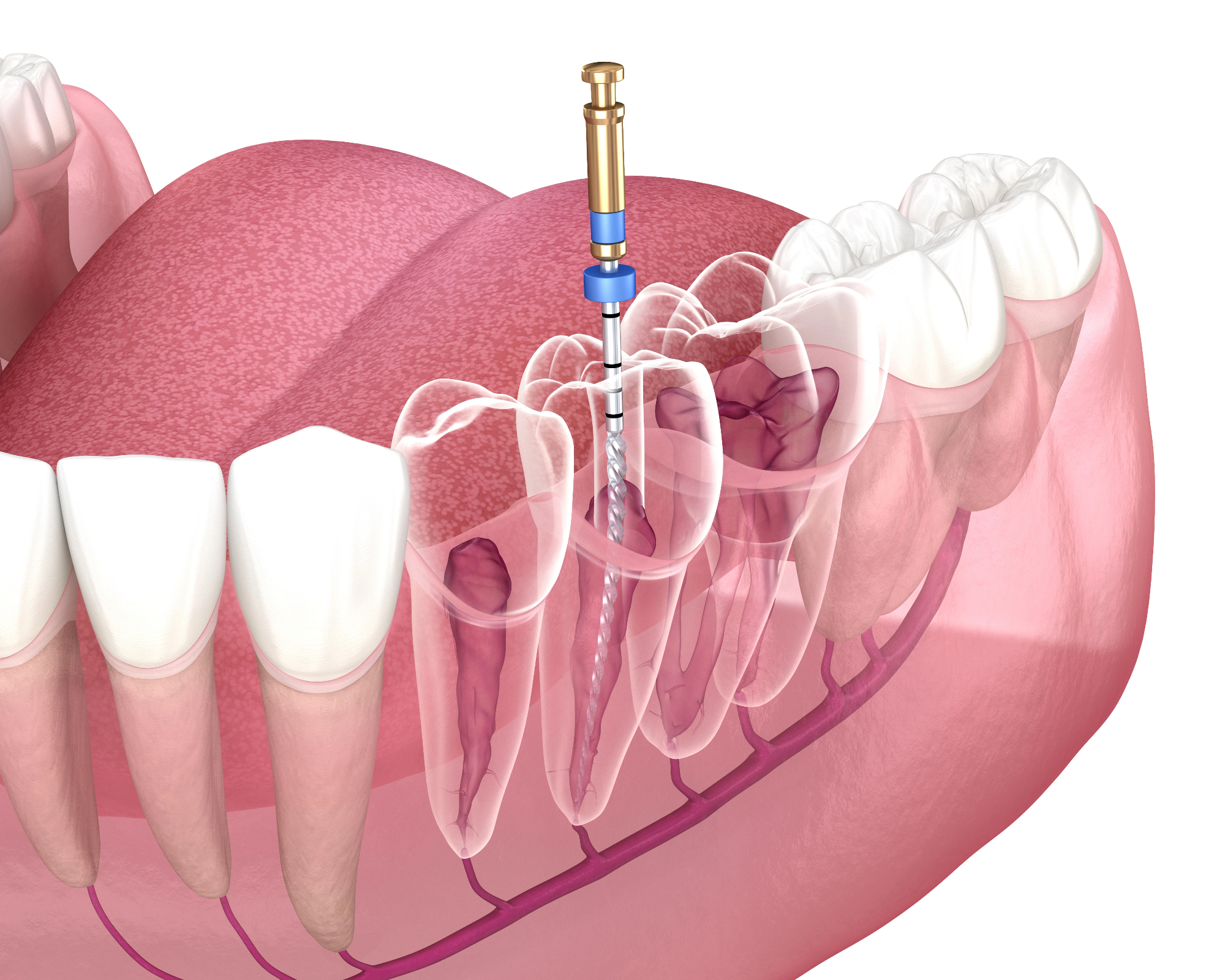 Endodontija mi je rešila težave z zobmi